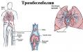 Tromboembolismus plicní tepny (PE) Známky vaskulárního tromboembolismu