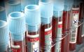 قواعد جمع المواد البيولوجية لإجراء دراسة للكشف عن فيروس نقص المناعة البشرية - طرق تشخيص العدوى