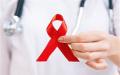AIDSi tekke ja leviku ajalugu